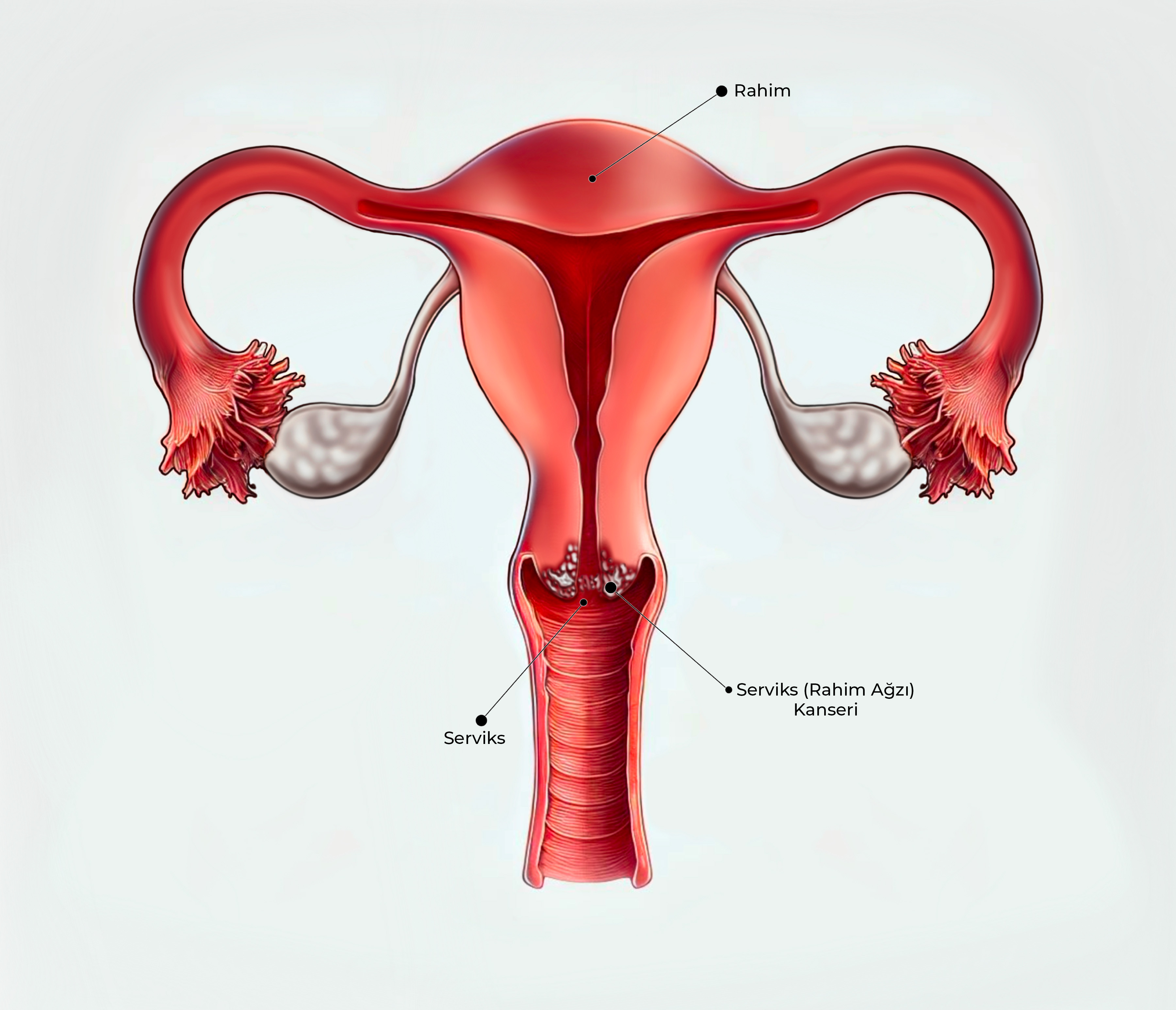 Serviks (Rahim Ağzı) Kanseri