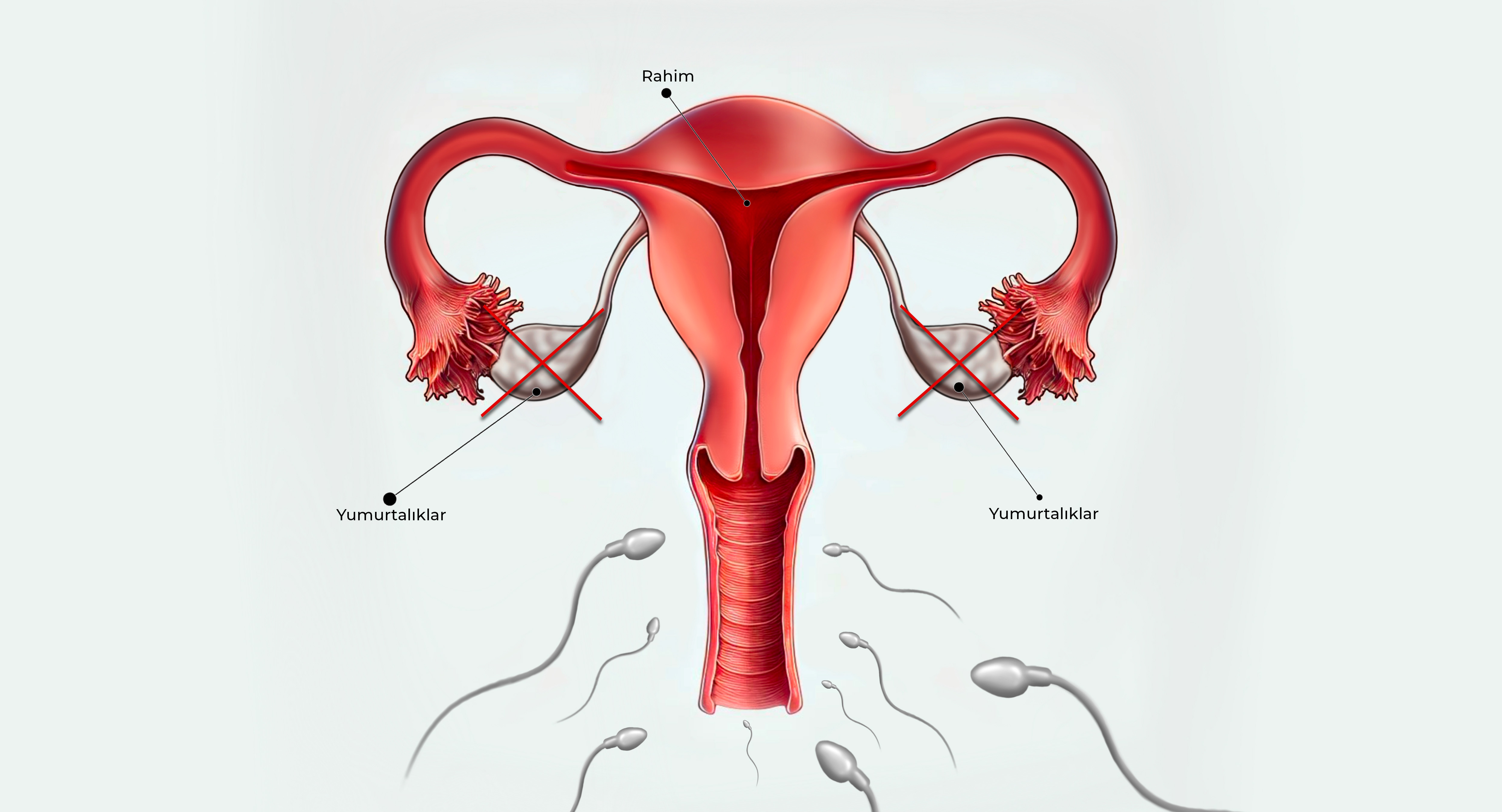 Kısırlık Görseli