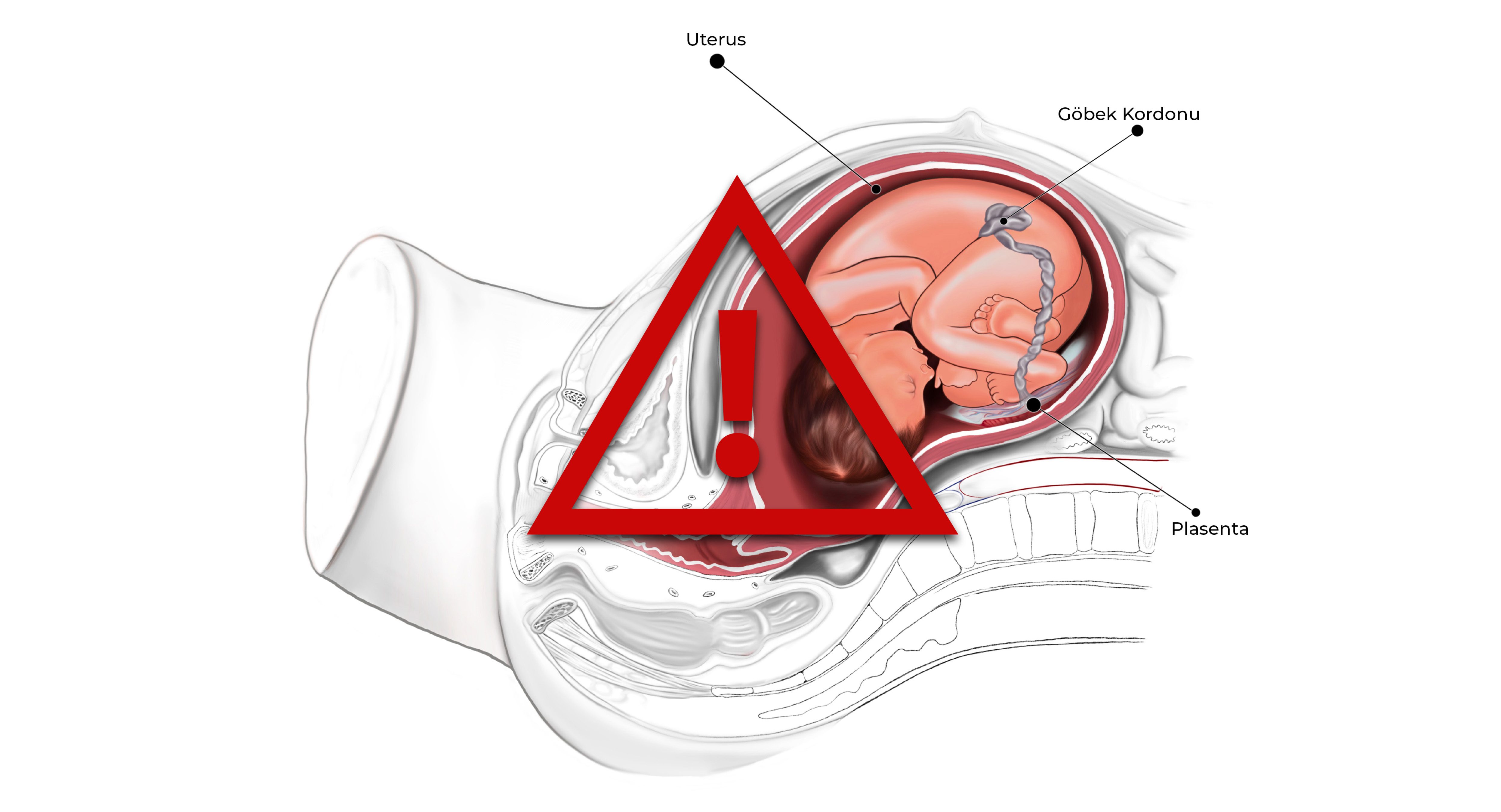 Riskli Gebelik Görseli